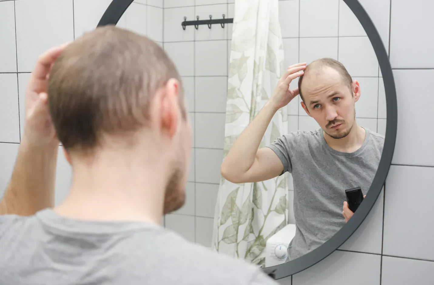 5 Ways to Deal with Hair Loss